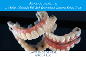 All-on-X Implants: A Modern Solution for Full-Arch Restoration at Lawrence Dental Group