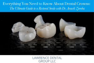 Everything You Need to Know About Dental Crowns A Guide from Dr. Araceli Ziemba at Lawrence Dental Group